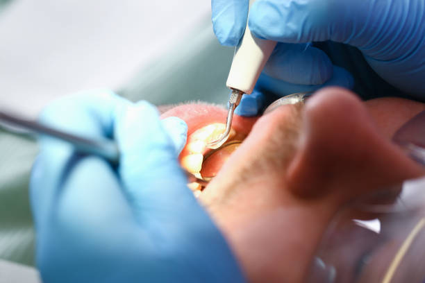 Best Tooth Pain Emergency Relief  in Attica, IN