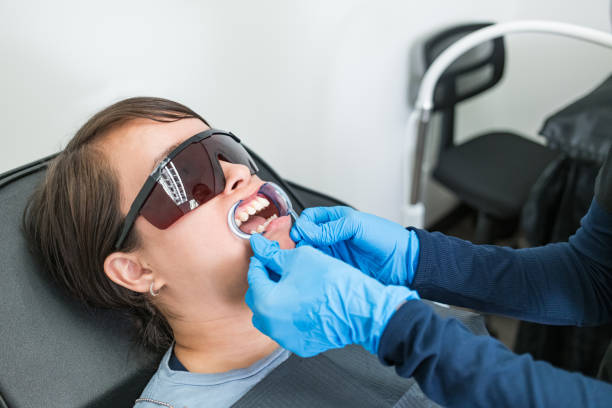 Best Chipped Tooth Repair Near Me  in Attica, IN